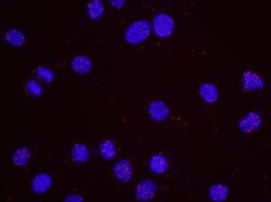 p53 Antibody, Novus Biologicals 0.1mL; Unlabeled:Antibodies, Polyclonal