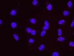 p53 Antibody, Novus Biologicals 0.1mL; Unlabeled:Antibodies, Polyclonal
