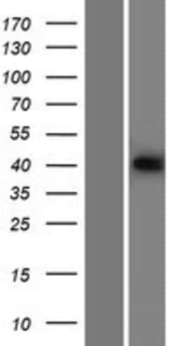Novus Biologicals&trade;&nbsp;p53R2 Overexpression Lysate