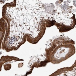 p53R2 Antibody, Novus Biologicals 0.1mL; Unlabeled:Antibodies, Polyclonal