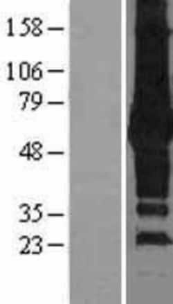 Novus Biologicals&trade;&nbsp;p62/SQSTM1 Overexpression Lysate
