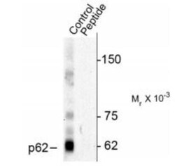 p62/SQSTM1, p Thr269, p Ser272 Antibody, Novus Biologicals 0.1mL; Unlabeled:Antibodies,