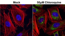p62/SQSTM1 Antibody (1478), Novus Biologicals 0.1mL; Unlabeled:Antibodies,