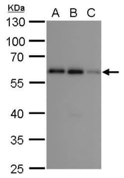 p62/SQSTM1 Antibody (1478), Novus Biologicals 0.1mL; Unlabeled:Antibodies,