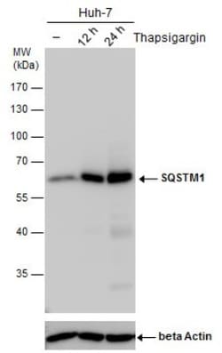 p62/SQSTM1 Antibody (1478), Novus Biologicals 0.1mL; Unlabeled:Antibodies,