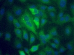 p62/SQSTM1 Antibody - BSA Free, Novus Biologicals 0.025mL; Unlabeled:Antibodies,