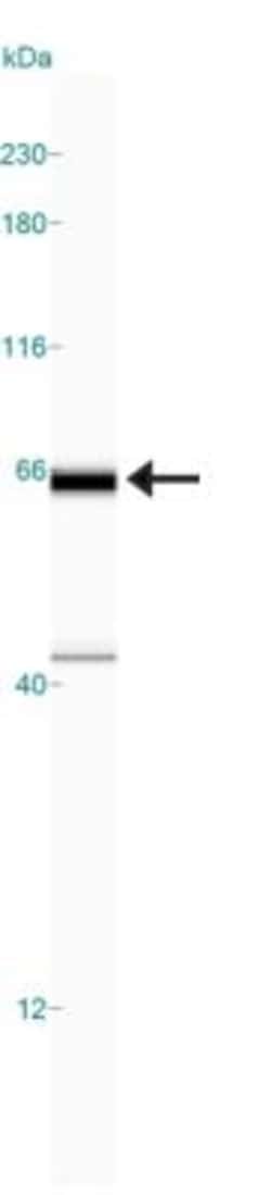 p62/SQSTM1 Antibody - BSA Free, Novus Biologicals 0.025mL; Unlabeled:Antibodies,