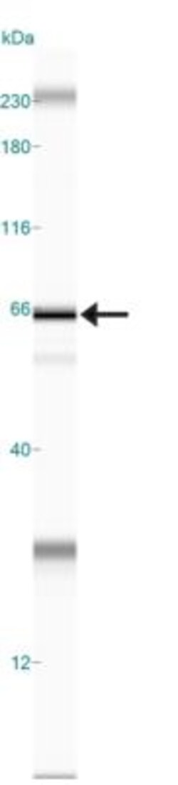 p62/SQSTM1 Antibody, Novus Biologicals 0.1mg; Unlabeled:Antibodies, Polyclonal