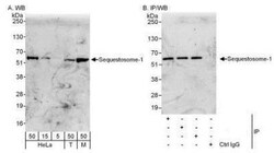 p62/SQSTM1 Antibody, Novus Biologicals 0.1mg; Unlabeled:Antibodies, Polyclonal