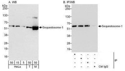 p62/SQSTM1 Antibody, Novus Biologicals 0.1mL; Unlabeled:Antibodies, Polyclonal