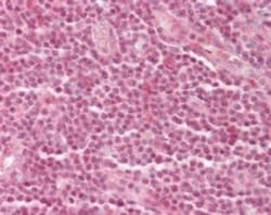p66 alpha Antibody, Novus Biologicals:Antibodies:Primary Antibodies