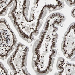 p66 alpha Antibody, Novus Biologicals:Antibodies:Primary Antibodies