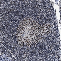 p66 beta Antibody, Novus Biologicals 25 &mu;L; Unlabeled:Antibodies, Polyclonal