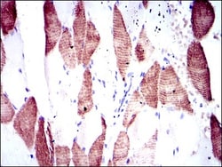 p70 S6 Kinase/S6K Antibody (5G9) - BSA Free, Novus Biologicals 0.1mL; Unlabeled:Antibodies,