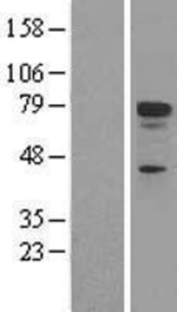 Novus Biologicals™ p73 Overexpression Lysate