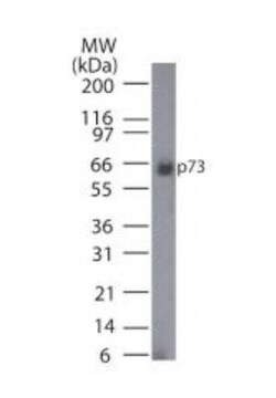 p73 Antibody (5B1288) - BSA Free, Novus Biologicals:Antibodies:Primary