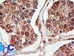 p73 Antibody (5B429) - BSA Free, Novus Biologicals:Antibodies:Primary Antibodies
