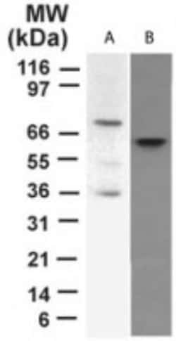p73 Antibody (5B429) - BSA Free, Novus Biologicals:Antibodies:Primary Antibodies
