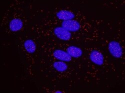 p73 Antibody, Novus Biologicals 0.1mL; Unlabeled:Antibodies, Polyclonal