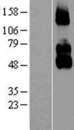 Novus Biologicals&trade;&nbsp;NGFR/TNFRSF16/p75NTR Overexpression Lysate