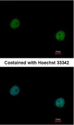 p97/VCP Antibody, Novus Biologicals 0.1mL; Unlabeled:Antibodies, Polyclonal