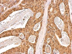 p97/VCP Antibody, Novus Biologicals 0.1mL; Unlabeled:Antibodies, Polyclonal