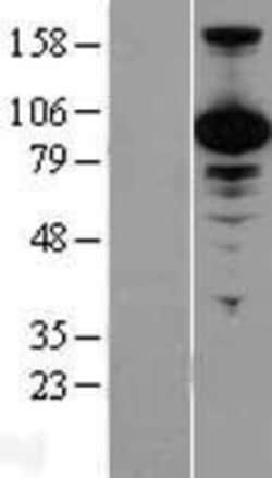 Novus Biologicals&trade;&nbsp;p97/VCP Overexpression Lysate