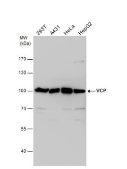 p97/VCP Antibody, Novus Biologicals 0.1mL; Unlabeled:Antibodies, Polyclonal