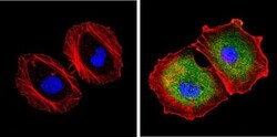 PA28 Activator beta Subunit/PSME2 Antibody, Novus Biologicals 100 &mu;L;
