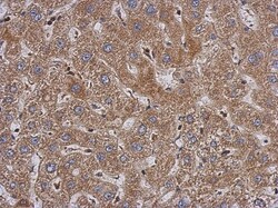 PABPC3 Antibody, Novus Biologicals 0.1mL; Unlabeled:Antibodies, Polyclonal