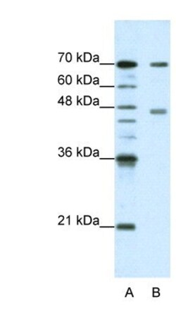 PABPC4 Antibody, Novus Biologicals 100 &mu;L | Buy Online | Novus Biologicals | Fisher Scientific