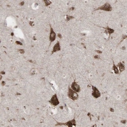PABPC5 Antibody, Novus Biologicals 0.1mL; Unlabeled:Antibodies, Polyclonal