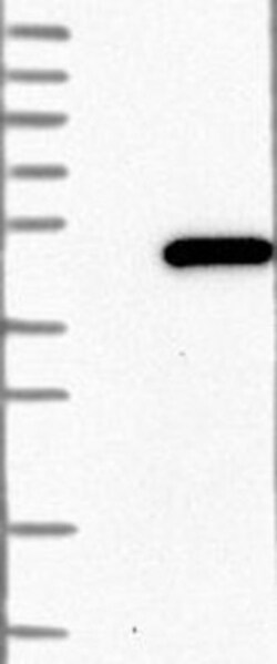 PABPC5 Antibody, Novus Biologicals 0.1mL; Unlabeled:Antibodies, Polyclonal