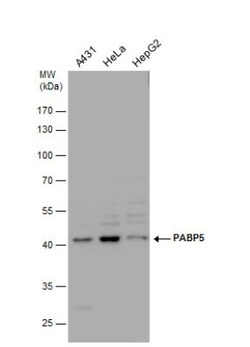 PABPC5 Antibody, Novus Biologicals 0.1mL; Unlabeled:Antibodies, Polyclonal