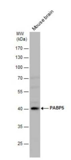 PABPC5 Antibody, Novus Biologicals 0.1mL; Unlabeled:Antibodies, Polyclonal