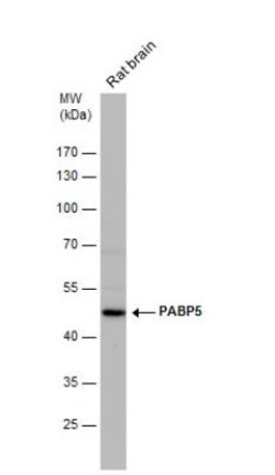 PABPC5 Antibody, Novus Biologicals 0.1mL; Unlabeled:Antibodies, Polyclonal
