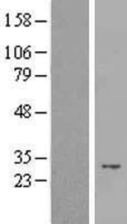 Novus Biologicals&trade;&nbsp;PAC2 Overexpression Lysate