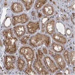 PAC2 Antibody, Novus Biologicals:Antibodies:Primary Antibodies