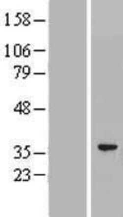 Novus Biologicals&trade;&nbsp;PACRG Overexpression Lysate