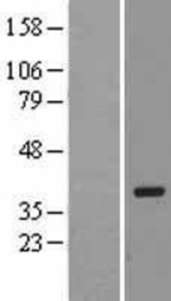 Novus Biologicals&trade;&nbsp;PACT Overexpression Lysate