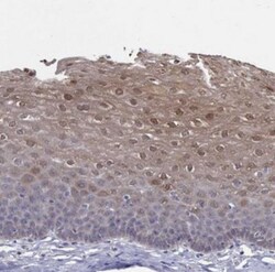 PADI1 Antibody, Novus Biologicals 25 &mu;L:Antibodies, Polyclonal