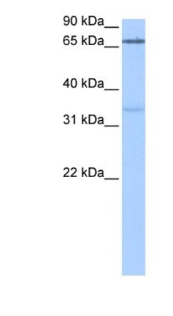 PADI2 Antibody, Novus Biologicals 0.05mg; Unlabeled:Antibodies, Polyclonal