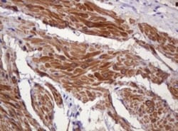 PADI4 Antibody (OTI5C10), Novus Biologicals 0.1mL; Unlabeled:Antibodies,