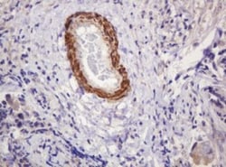 PADI4 Antibody (OTI5C10), Novus Biologicals 0.1mL; Unlabeled:Antibodies,