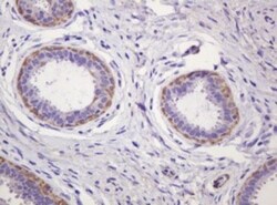 PADI4 Antibody (OTI5C10), Novus Biologicals 0.1mL; Unlabeled:Antibodies,
