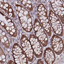 PAF1 Antibody, Novus Biologicals 25ul | Buy Online | Novus Biologicals | Fisher Scientific