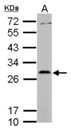 PAFAH1B2 Antibody, Novus Biologicals 0.1mL; Unlabeled:Antibodies, Polyclonal