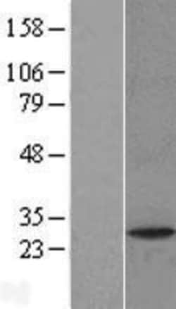 Novus Biologicals&trade;&nbsp;PAFAH1B2 Overexpression Lysate