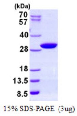 Novus Biologicals&trade;&nbsp;Recombinant Human PAFAH1B3 His Protein