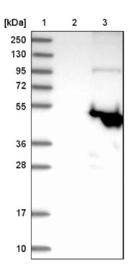 PAFAH2 Antibody, Novus Biologicals 0.1mL; Unlabeled:Antibodies, Polyclonal